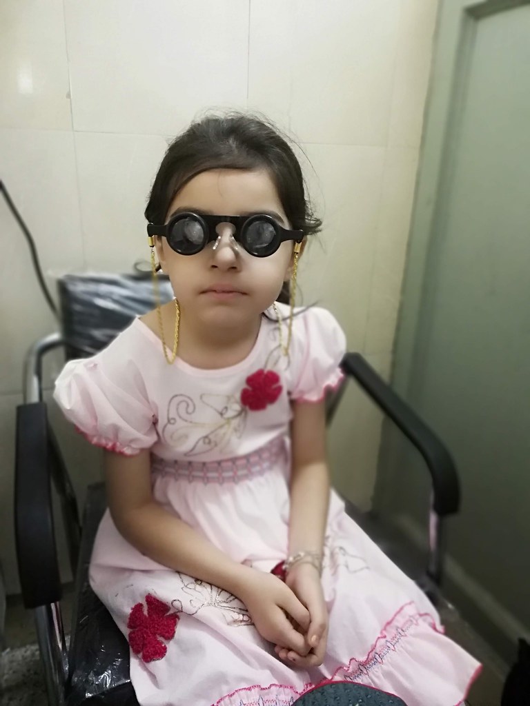 A visually impaired girl with a pink dress and red roses sitting in a wheelchair and wearing a black binocular telescope